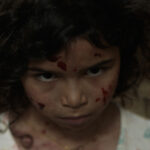 Young girl with blood on her face looking sad