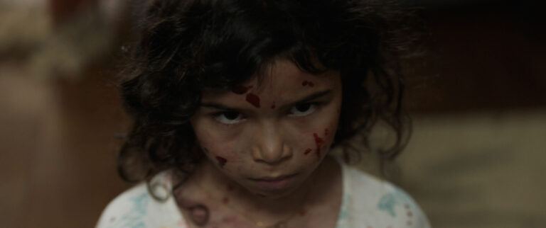 Young girl with blood on her face looking sad